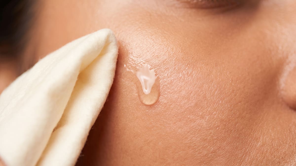 Acne in Pune's Humid Weather: A Dermatologist's Playbook