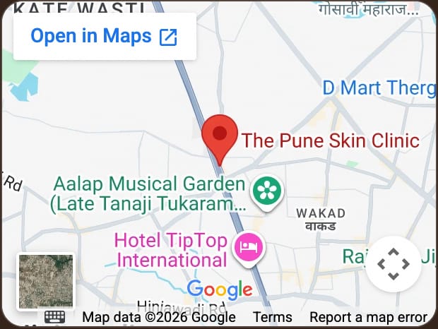 Map to The Pune Skin Clinic, WBiz Mall, Tathawade