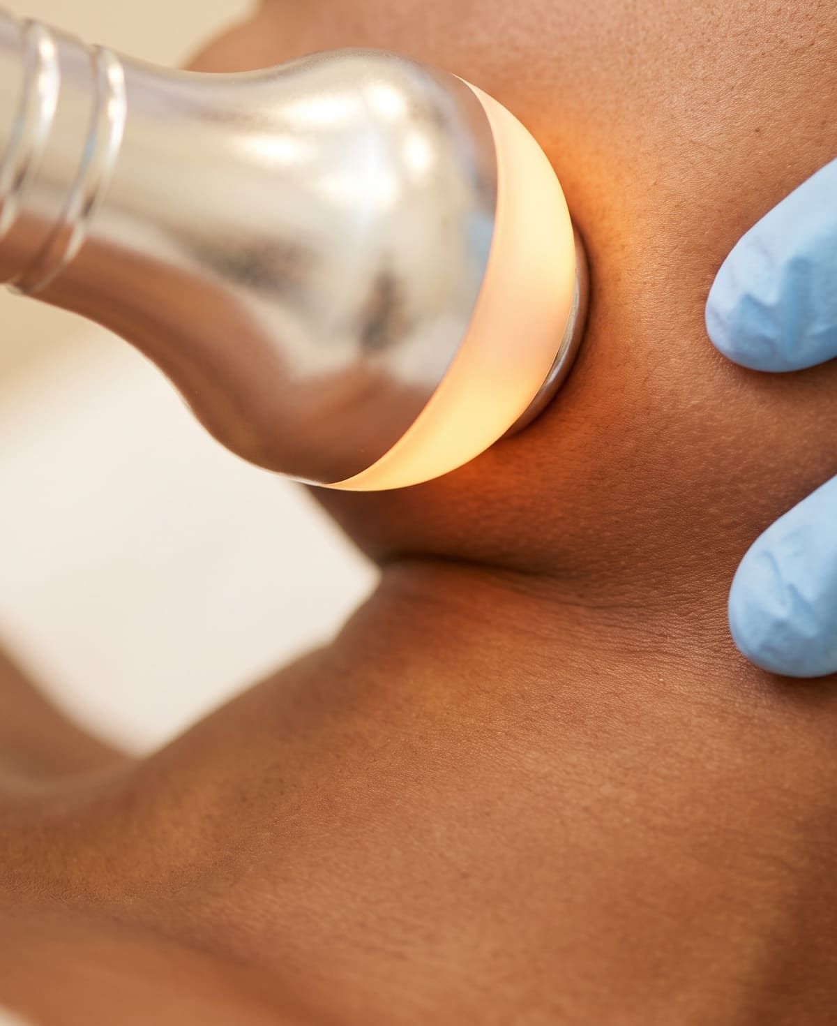 Radiofrequency skin-tightening applicator on the skin during an anti-aging treatment