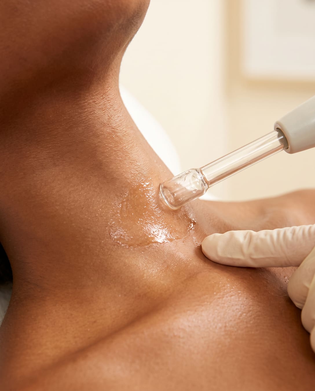 Hydrafacial treatment wand gliding over the neck and collarbone skin