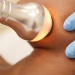 Radiofrequency skin-tightening applicator on the skin during an anti-aging treatment