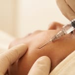 Fine syringe injecting dermal filler beneath the skin