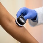 Dermatoscope examining Indian skin during a clinical diagnosis