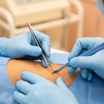 Gloved hands removing a small skin lesion with surgical instruments